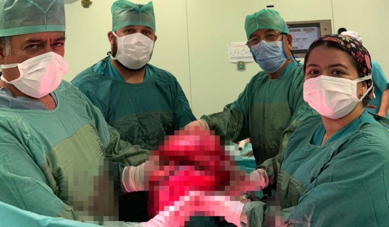Yemek yiyememe şikayetiyle hastaneye başvuran 71 yaşındaki bayanın karnından 9 kilo tümör çıkarıldı