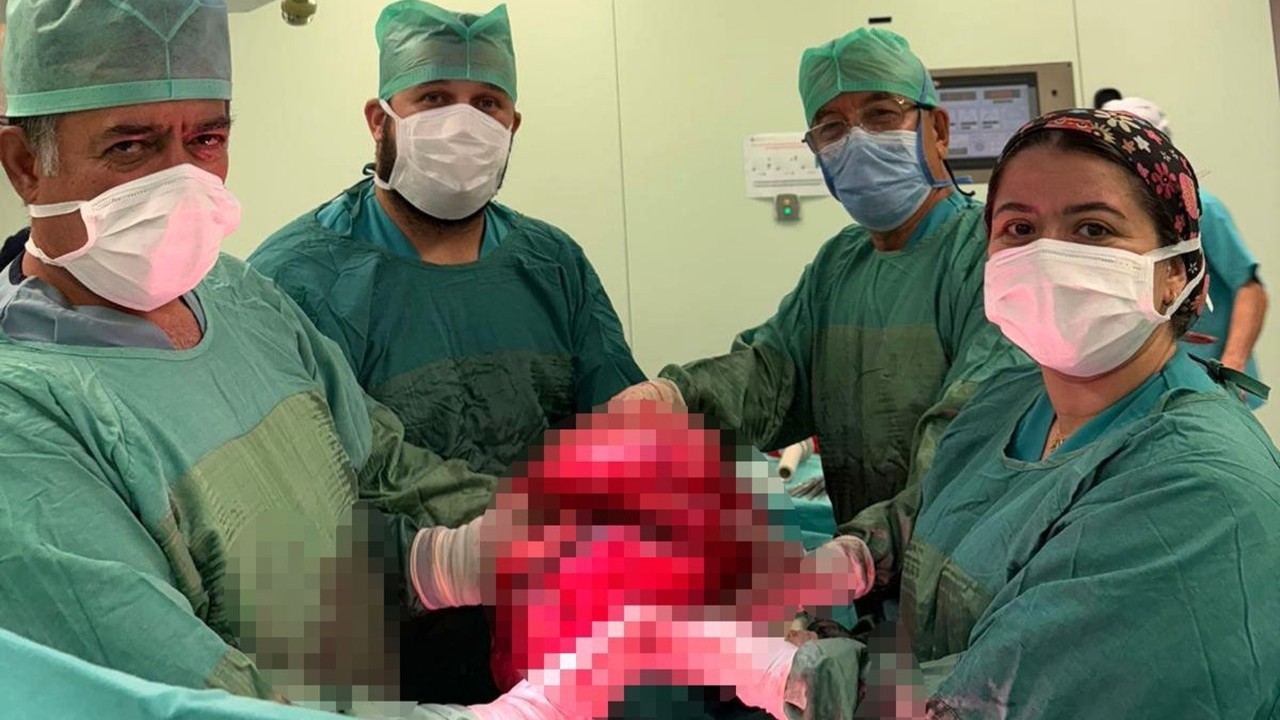 yemek-yiyememe-sikayetiyle-hastaneye-basvuran-71-yasindaki-bayanin-karnindan-9-kilo-tumor-cikarildi-hjD1Fa1v.jpg