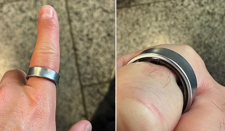 Yüzüğü yüzünden uçağa alınmadı: Acilen hastaneye kaldırıldı