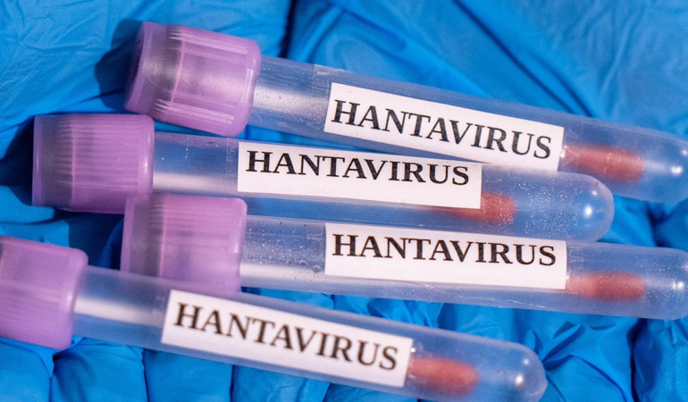 avustralyadan-hantavirus-tedbiri-karantina-muhleti-uzatildi-c4G9ryCd.jpg