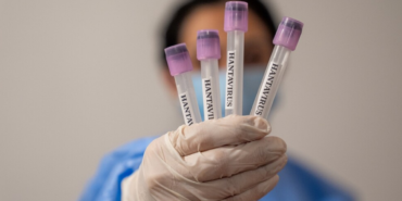 bakan-memisoglu-acikladi-hantavirus-konusunda-bir-salgin-riski-var-mi-OW9L7HlJ.png