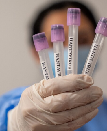 bakan-memisoglu-acikladi-hantavirus-konusunda-bir-salgin-riski-var-mi-OW9L7HlJ.png