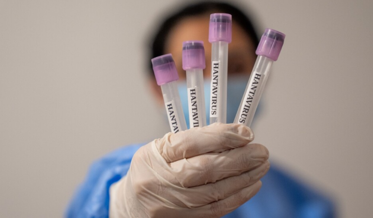 bakan-memisoglu-acikladi-hantavirus-konusunda-bir-salgin-riski-var-mi-OW9L7HlJ.png