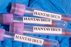 dsoden-aciklama-hantavirus-global-sihhat-icin-risk-olusturuyor-mu-LeUSn4CT.jpg