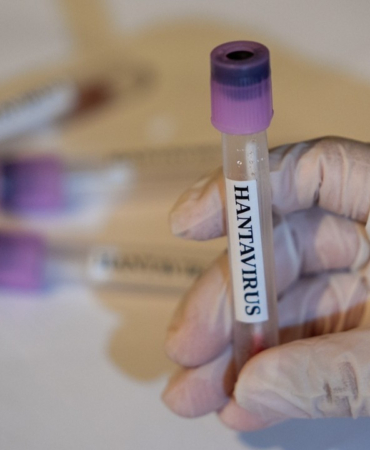 dsoden-hantavirus-aciklamasi-global-risk-var-mi-IvYdhw6J.jpg
