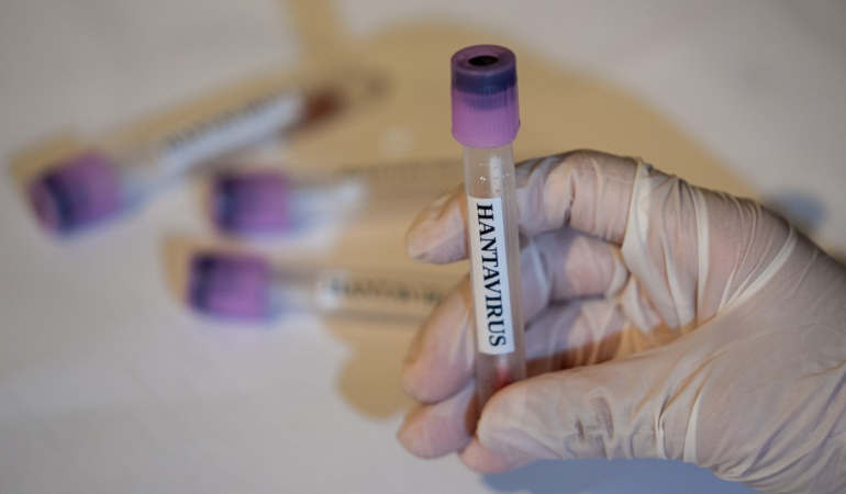 dsoden-hantavirus-aciklamasi-global-risk-var-mi-IvYdhw6J.jpg