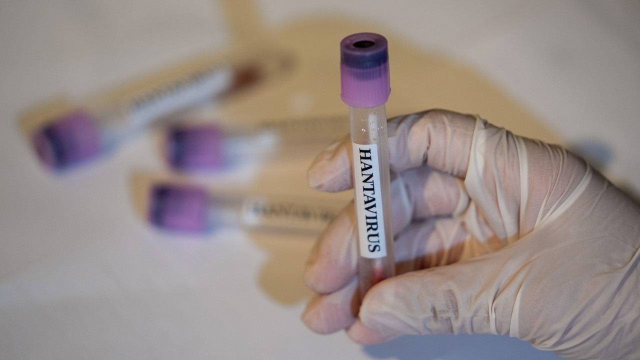 hantavirus-alarmi-buyuyor-abd-ve-fransadan-muspet-olay-aciklamasi-sKxvcCew.jpg